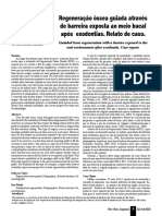 06 ROG Através de Barreira Exposta Ao Meio Bucal Após Exodontias. Relato de Caso IBI 2010