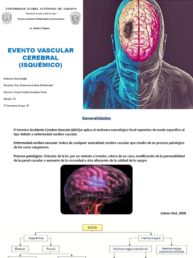 Clasificación Del Evc Isquémico Pdf Carrera Isquemia 