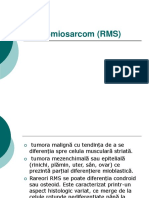 Rabdomiosarcom (RMS)