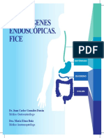 Atlas de imágenes endoscópicas - FICE.pdf