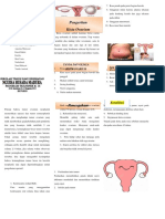 MENGENAL DAN MENCEGAH KISTA OVARIUM