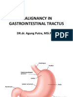 Malignancy in the Gastrointestinal Tract