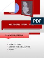 Kelainan Pada Janin