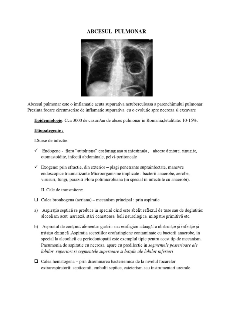 Abces pulmonar : cauze, diagnostic, tratament - Scăderea în greutate a abcesului pulmonar