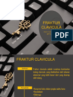 Fraktur Clavicula