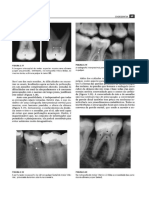 Endo - Aula3