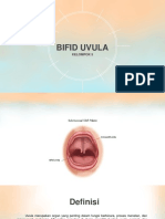 BIFID UVULA