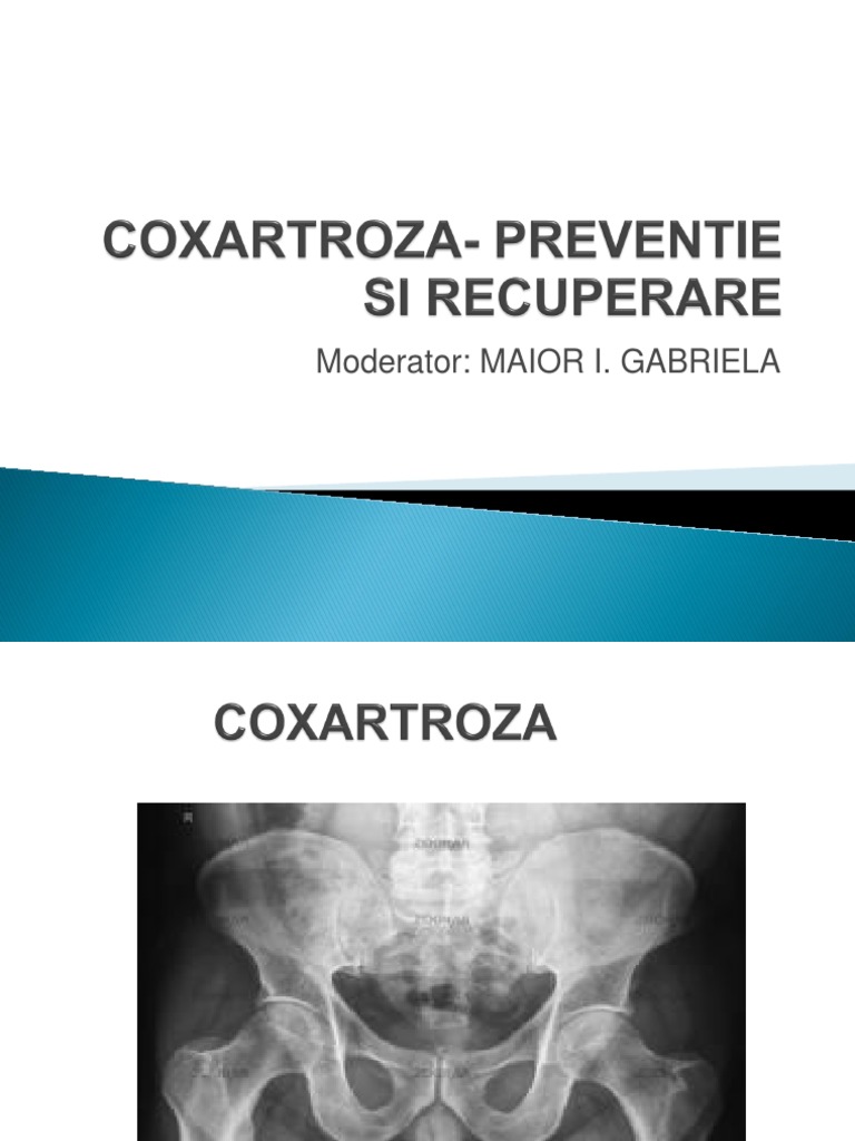 Coxartroza Preventie Si Recuperare | PDF
