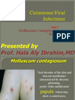 Molluscum Contagiosum. Warts.: Presented by