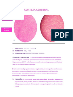 Anemia de Celulas Falciformes