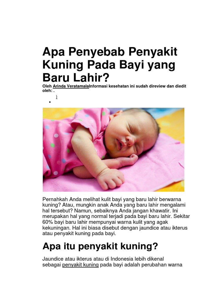 Perubahan Warna Kulit Bayi Baru Lahir Perubahan Warna Kulit Bayi Baru Lahir