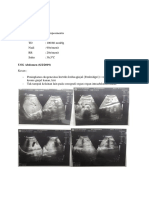 CTTN Azotemia