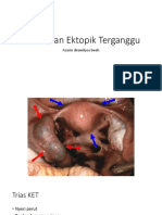 Kehamilan Ektopik Terganggu