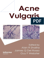 Acne Vulgaris PDF