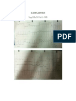 ELEKTROKARDIOGRAM Sanwiyah