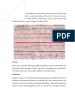 Torsade de Pointes