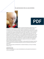 progeria