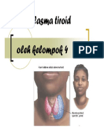 Patologi Anatomi Slide Neoplasma Tiroid