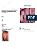 PSORIASIS VULGARIS.docx