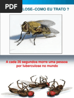 tratamento de tuberculose