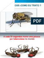 tratamento de tuberculose