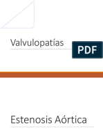 Valvulopatias PDF
