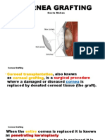 Cornea Grafting