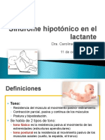 Síndrome Hipotónico PDF