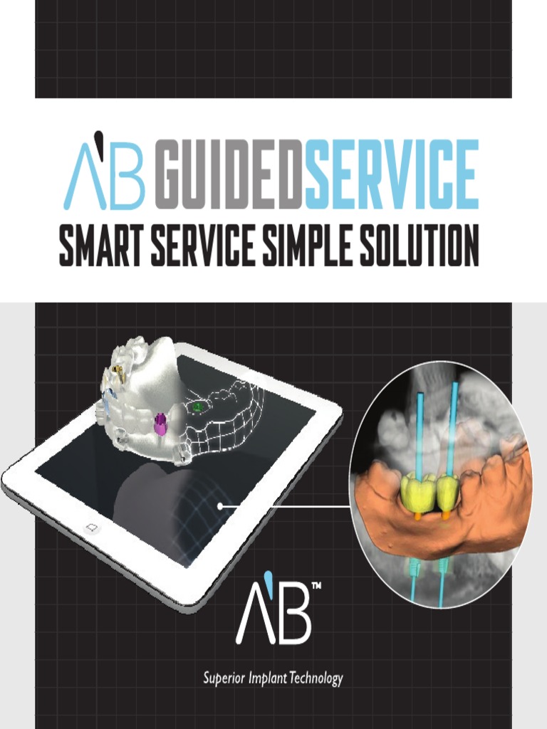 AB Guided Dental Implant Service | PDF | Dental Implant | Dentures