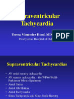 SVT Presentation