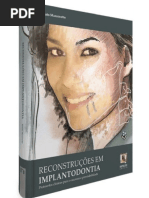 Em Implantodontia Mazzonetto 1