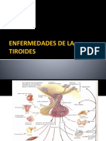 Hipotiroidismo PDF