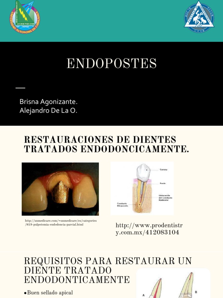 Tipos y Funciones de Endopostes Dentales | PDF | Dentadura postiza | Diente