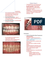 Periodontology Prelims Topic 3: Periodontitis
