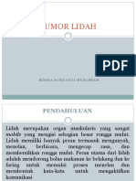 Tumor Lidah