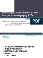 Hemoptysis: Contribution of The Computed Tomography (CT) : CC CBG