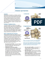 Degenerative Disc Disease (Spondylosis)