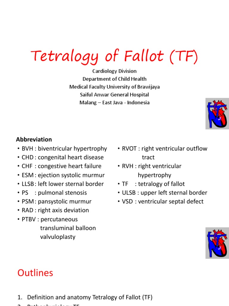 Tetralogy of Fallot Overview and Management | PDF | Congenital Heart ...
