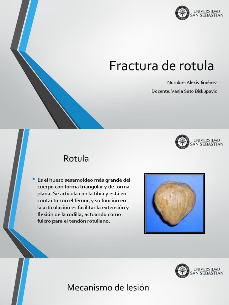 Clasificación de fracturas de rótula | PDF | Rodilla | Sistema esquelético
