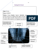 Radiografías Oclusales Arcada Superior e Inferior y Técnica de Clark