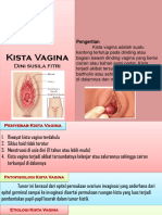 Kista Vagina