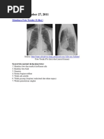 Trikotaj ignalari bilan yoqani toqing