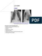 Cara Membaca Foto Toraks (X-Ray) Secara Sistematis dan Menuliskan Ekspertise Radiologi Dengan Kurang Dari