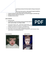 Crouzon Syndrome