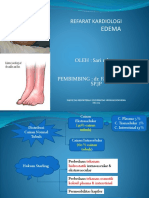 PPT Fix Edema