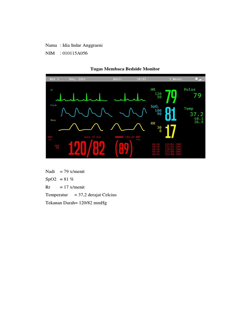 Bedside Monitor Reading Task | PDF