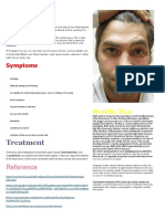 Bell Palsy.docx