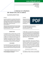 Calculos displasia de cadera.pdf