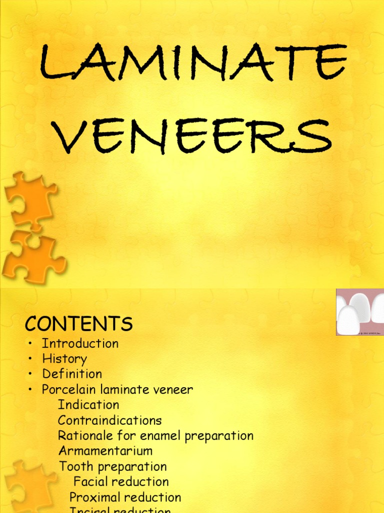 Laminate Veneers | PDF | Dental Composite | Human Tooth