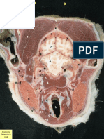 anatomia de la cabeza